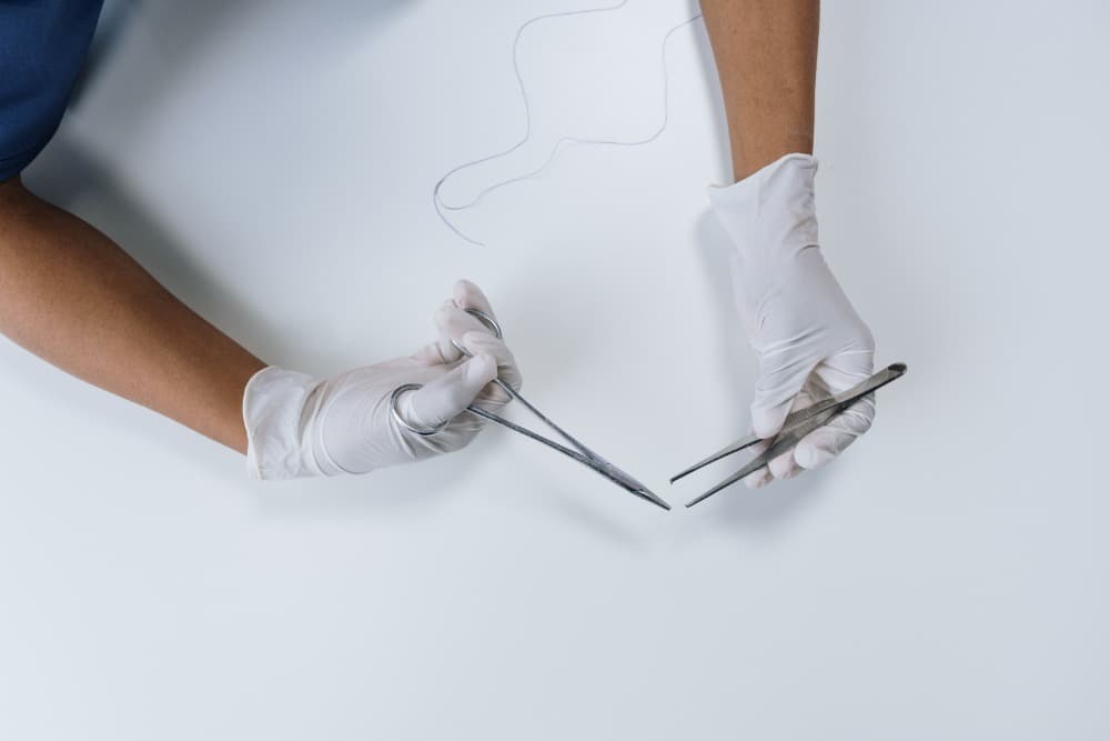 Situaties waarin we plastische chirurgie afraden